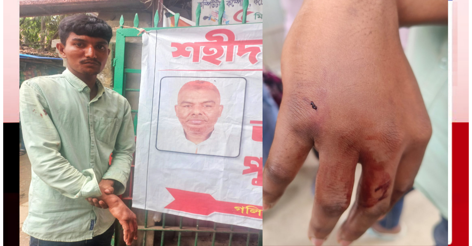 ফতুল্লায় বরিশাইল্লা শহিদ বাহিনীর হামলায় হৃদয়ের আঙ্গুলের হাড় দ্বিখন্ডিত!