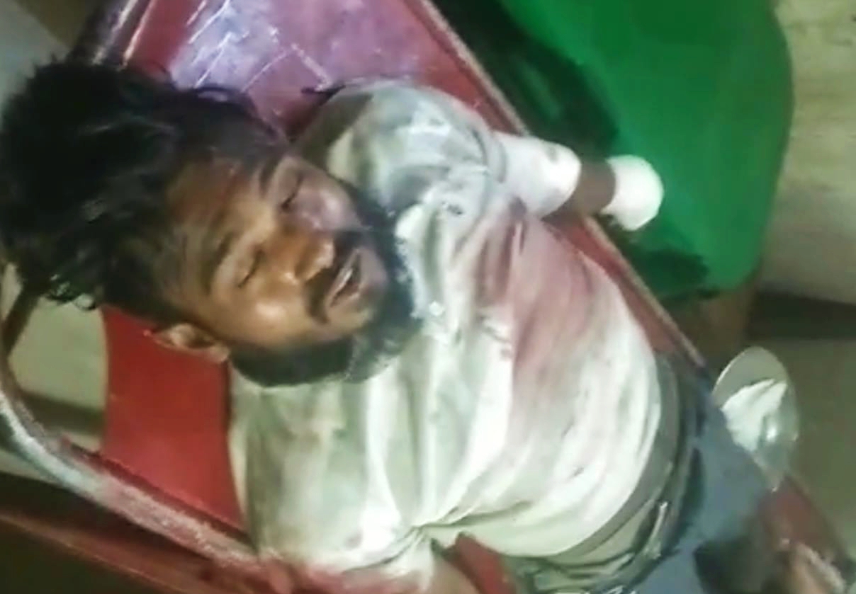 ফতুল্লায় পুলিশের কথিত সোর্স মামুনকে কুপিয়ে জখম